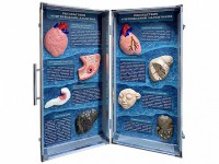 Учебно-демонстрационный кейс "Последствия употребления алкоголя и наркотиков" - fgospostavki.ru - Зеленогорск