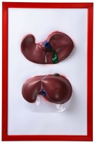 Барельефная модель "Печень" - fgospostavki.ru - Зеленогорск