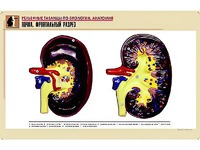 Рельефная таблица "Почка. Фронтальный разрез" (формат А1, матовое ламинирование) - fgospostavki.ru - Зеленогорск