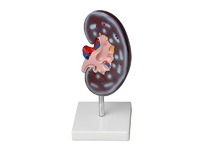 Модель почки в разрезе - fgospostavki.ru - Зеленогорск