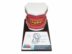Демонстрационная модель "Ротовая полость курильщика" - fgospostavki.ru - Зеленогорск