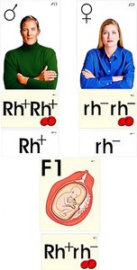 Модель-аппликация "Наследование резус-фактора" (ламинированная) - fgospostavki.ru - Зеленогорск