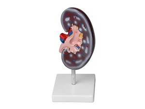 Модель почки в разрезе - fgospostavki.ru - Зеленогорск